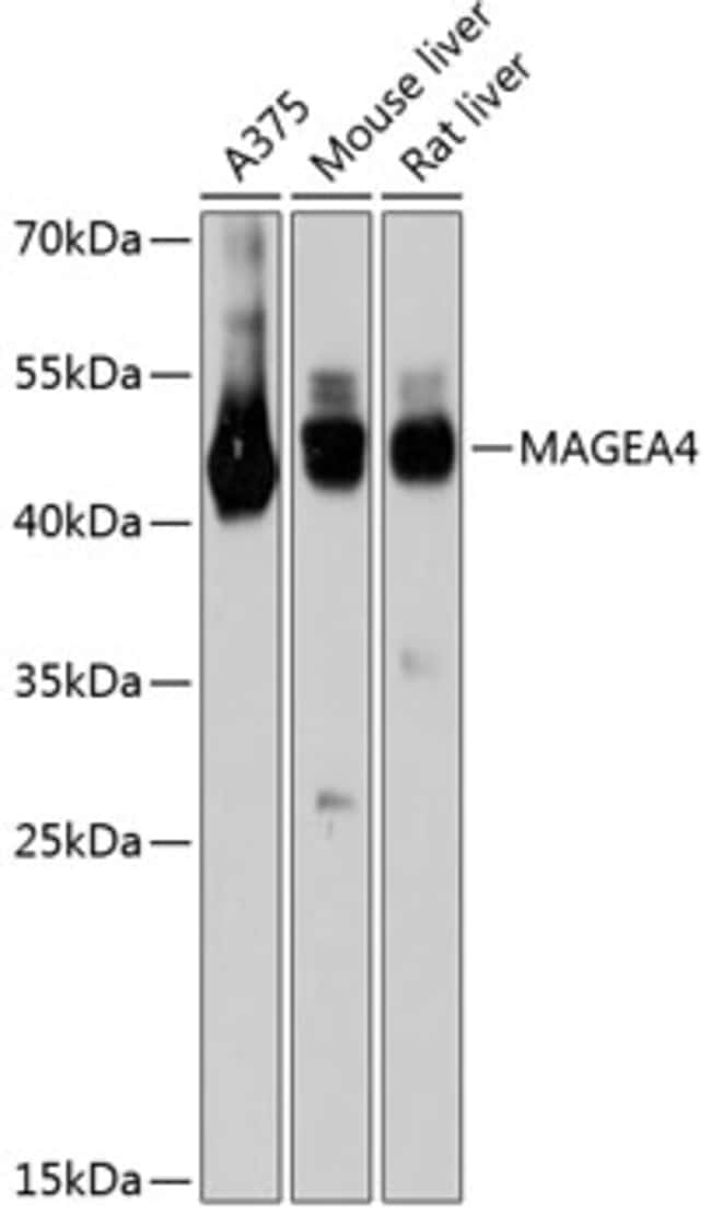 100UL MAGEA4 ANTIBODY 100 ul