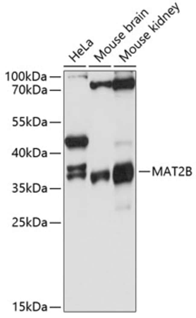 100UL MAT2B ANTIBODY 100 ul