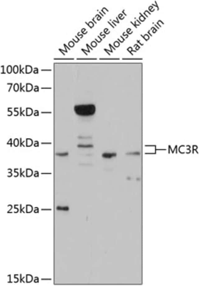 100UL MC3R ANTIBODY 100 ul