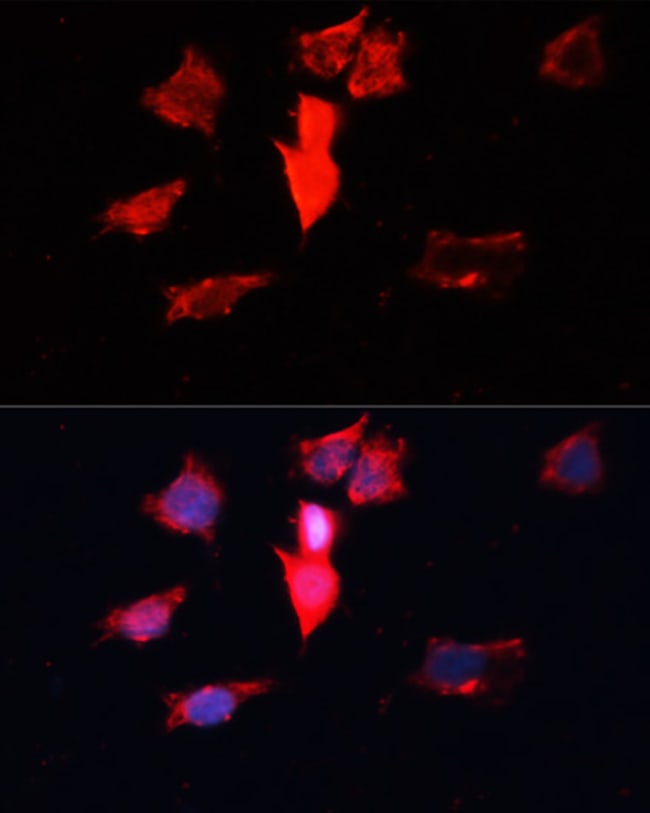 100UL CALMODULIN 3 ANTIBODY 100 ul