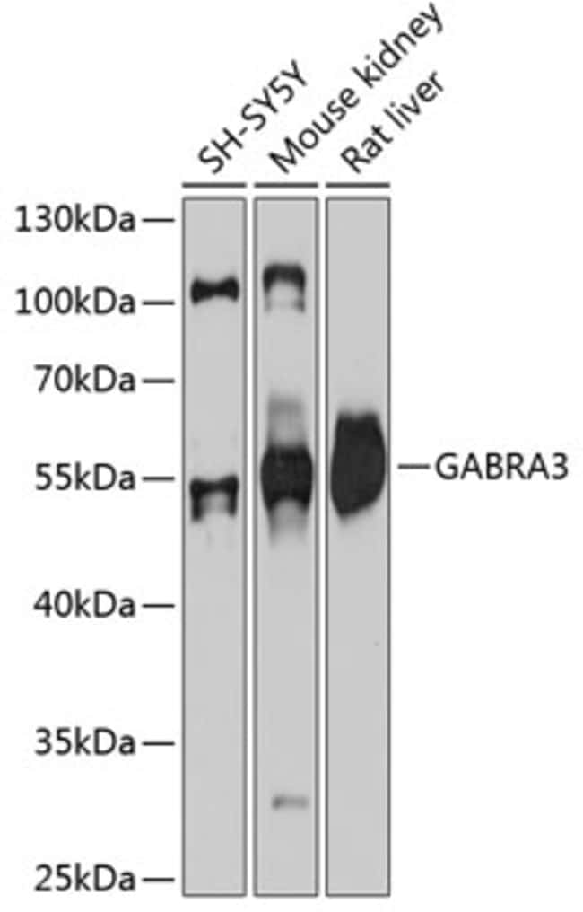 100UL GABRA3 ANTIBODY 100 ul