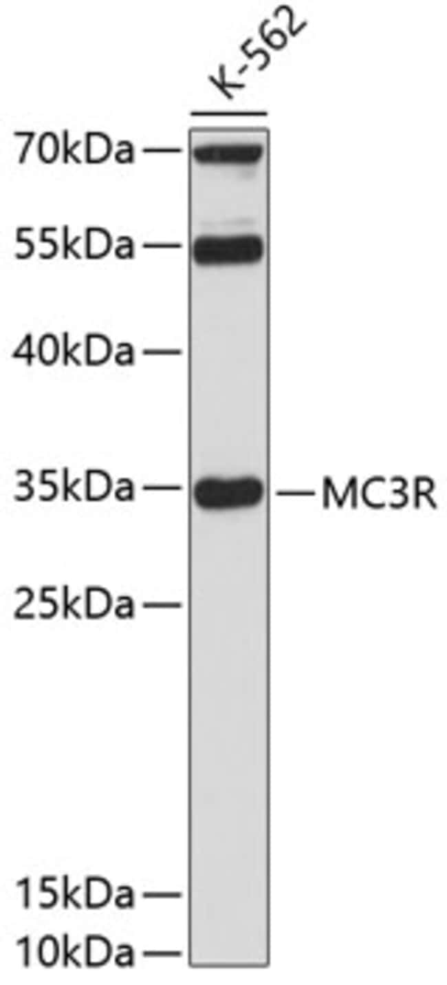 100UL MC3R ANTIBODY 100 ul