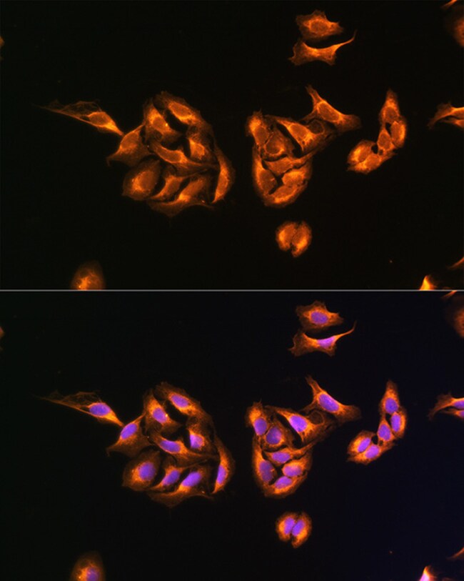 100UL MRPS27 ANTIBODY 100 ul