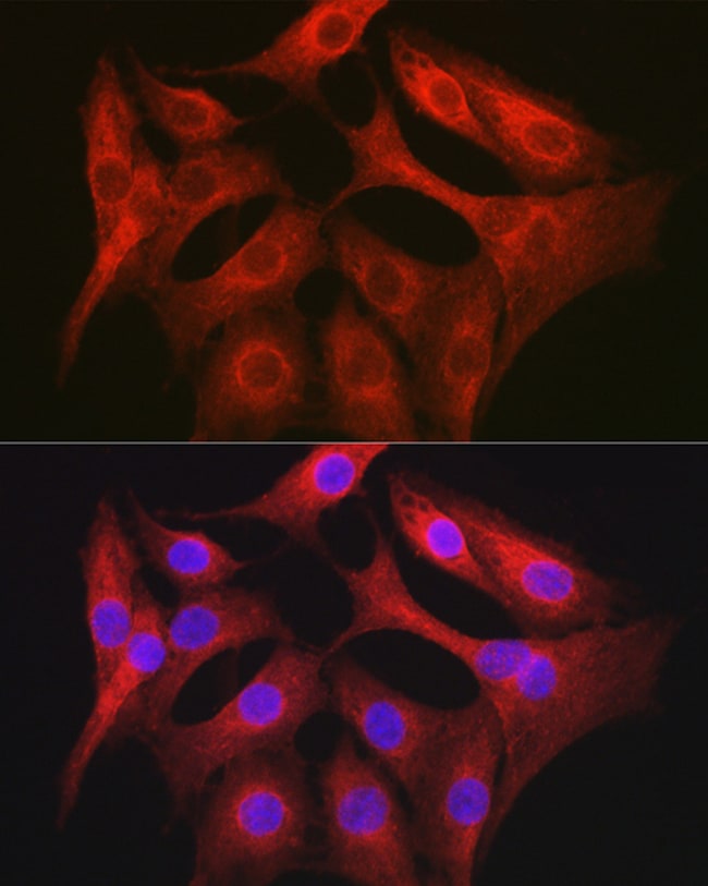 100UL GTPBP9 ANTIBODY 100 ul