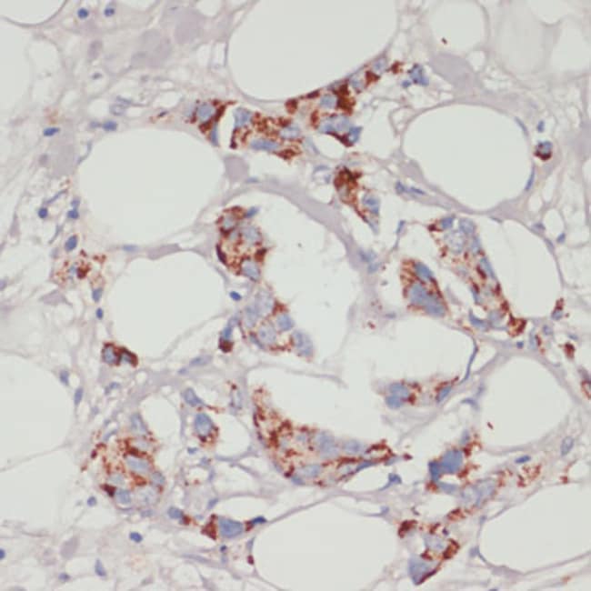 100UL ACSL3 ANTIBODY 100 ul
