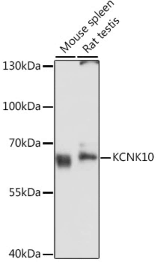 100UL KCNK10 ANTIBODY 100 ul