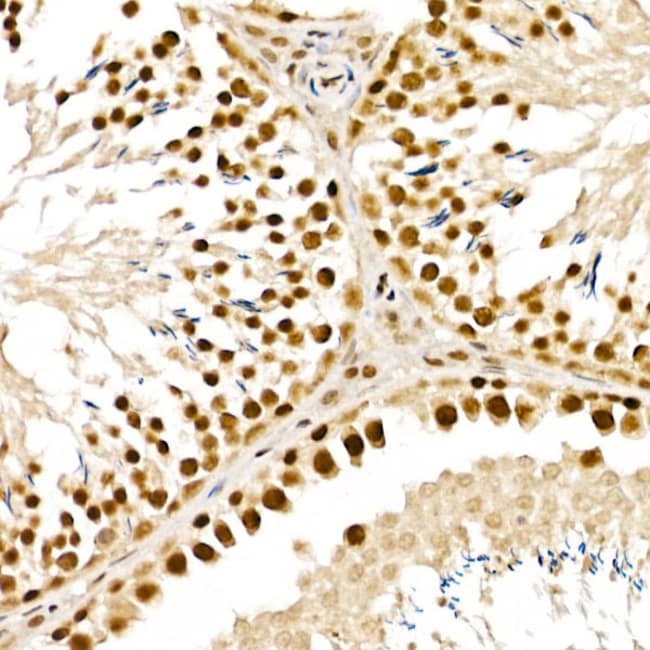 100UL ALKBH5 ANTIBODY 100 ul