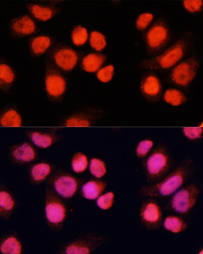 100UL CHAMP1 ANTIBODY 100 ul