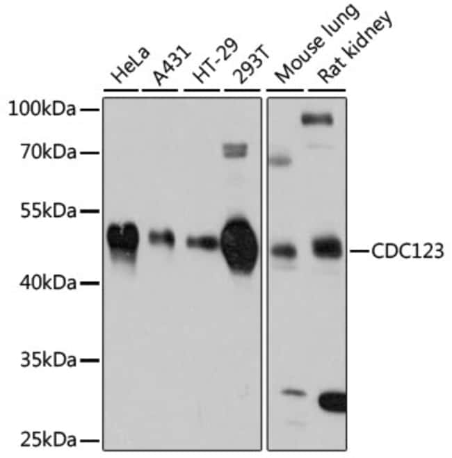 100UL CDC123 ANTIBODY 100 ul