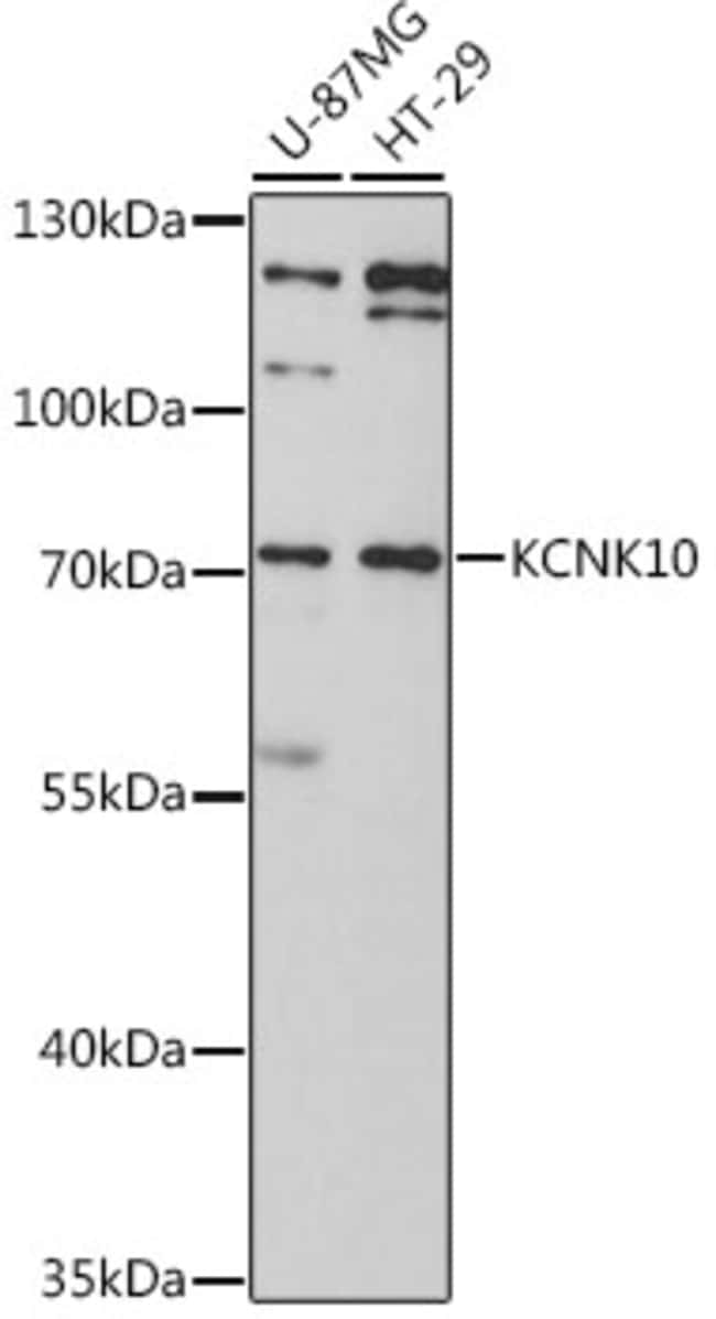 100UL KCNK10 ANTIBODY 100 ul