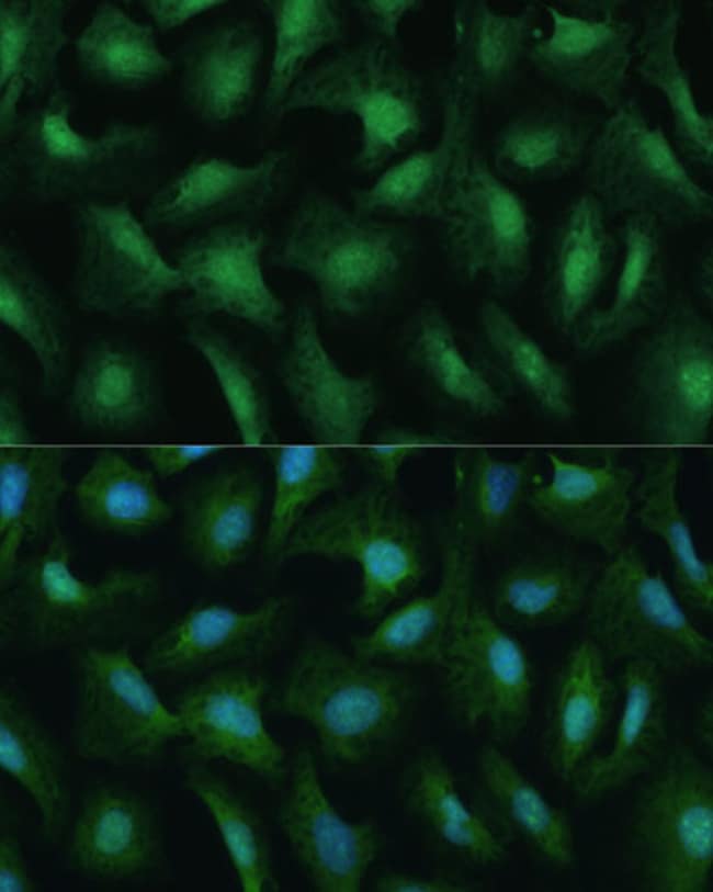 100UL DDX3Y ANTIBODY 100 ul