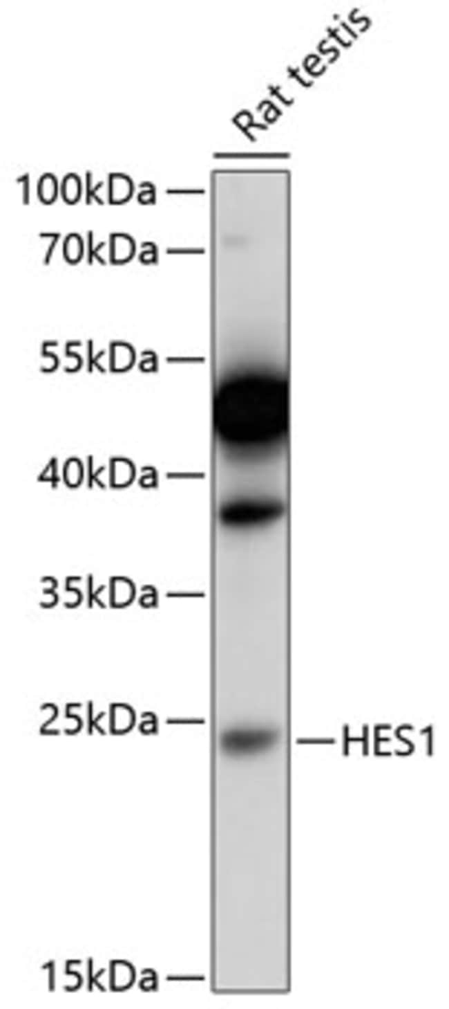 100UL HES1 ANTIBODY 100 ul