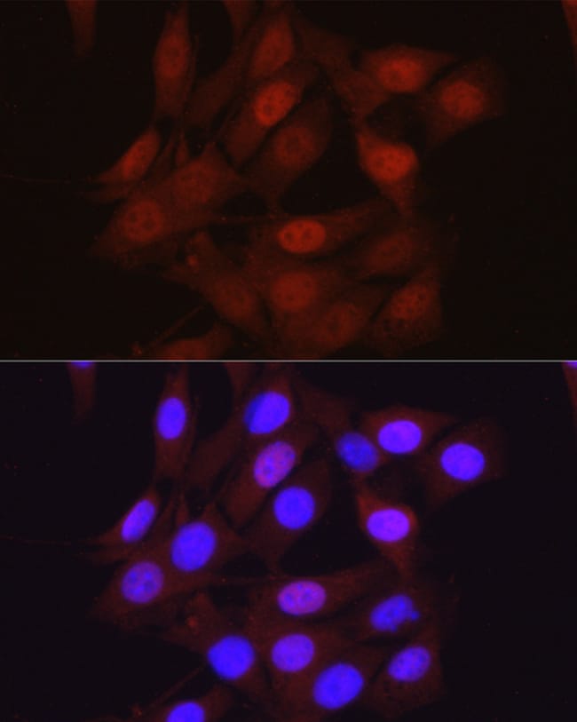 100UL BETA-ARRESTIN 2 ANTIBODY 100 ul