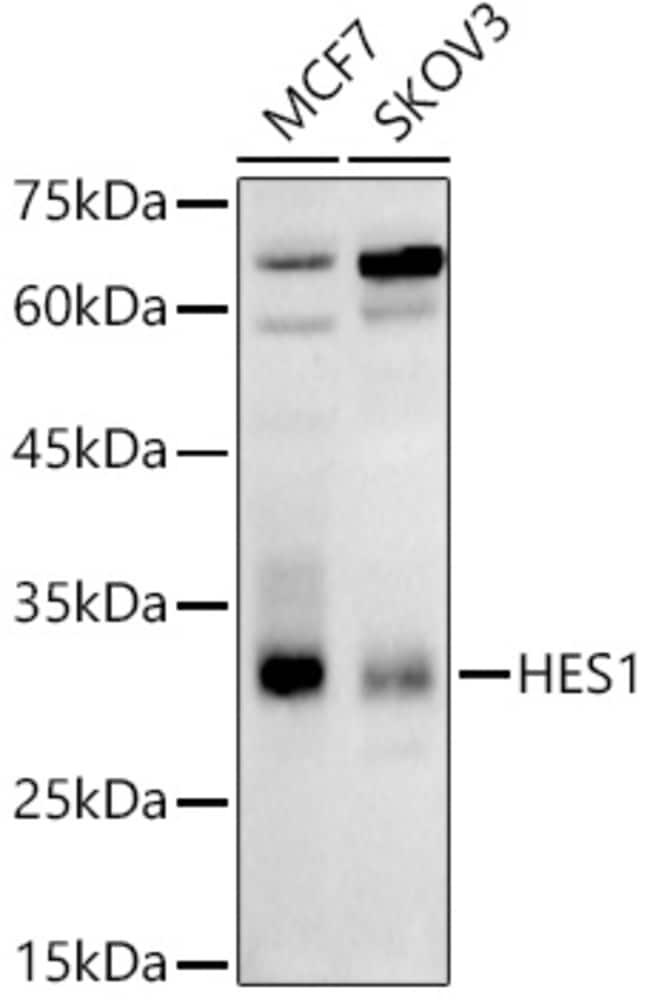 100UL HES1 ANTIBODY 100 ul