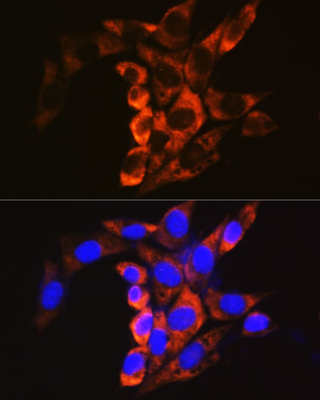 100UL CALPAIN 1 ANTIBODY 100 ul