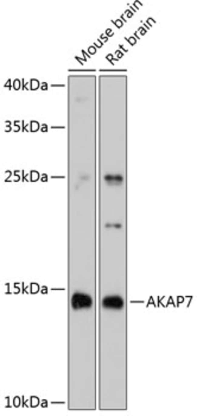 100UL AKAP7 ANTIBODY 100 ul