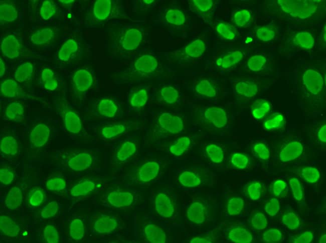 100UL FEN1 ANTIBODY 100 ul