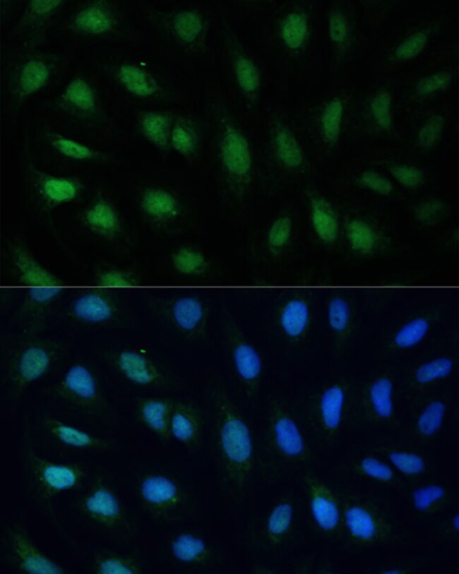 100UL GADD45A ANTIBODY 100 ul