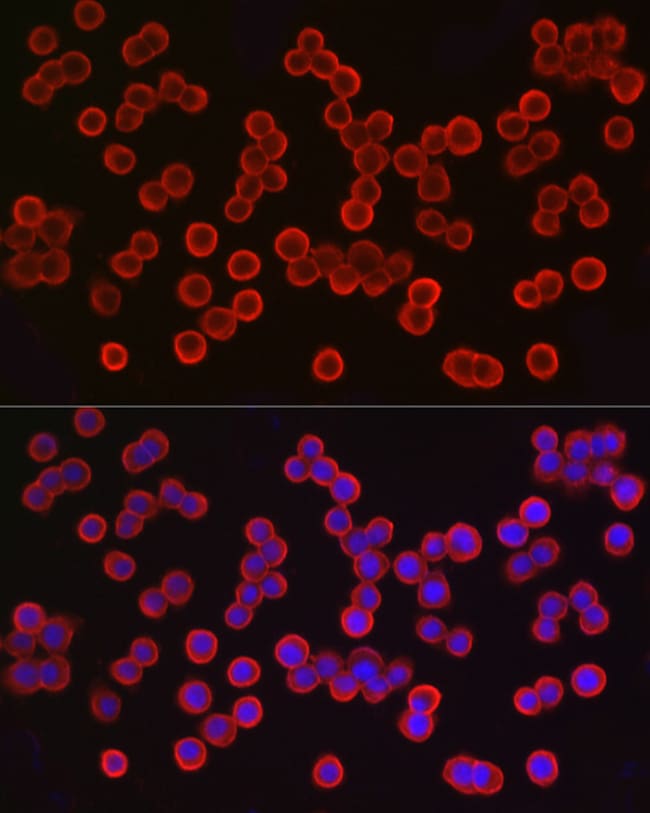 100UL EPCAM ANTIBODY 100 ul
