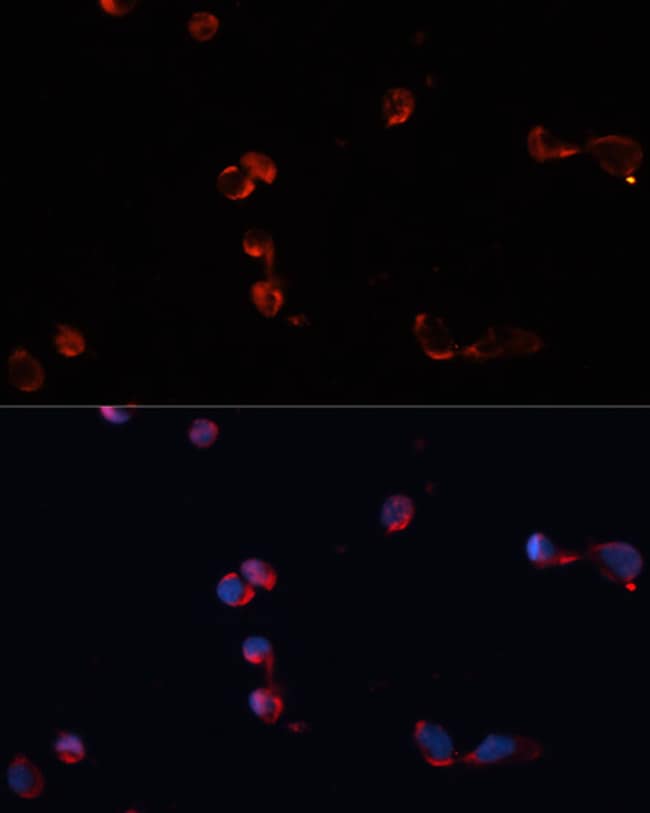 100UL CATALASE ANTIBODY 100 ul