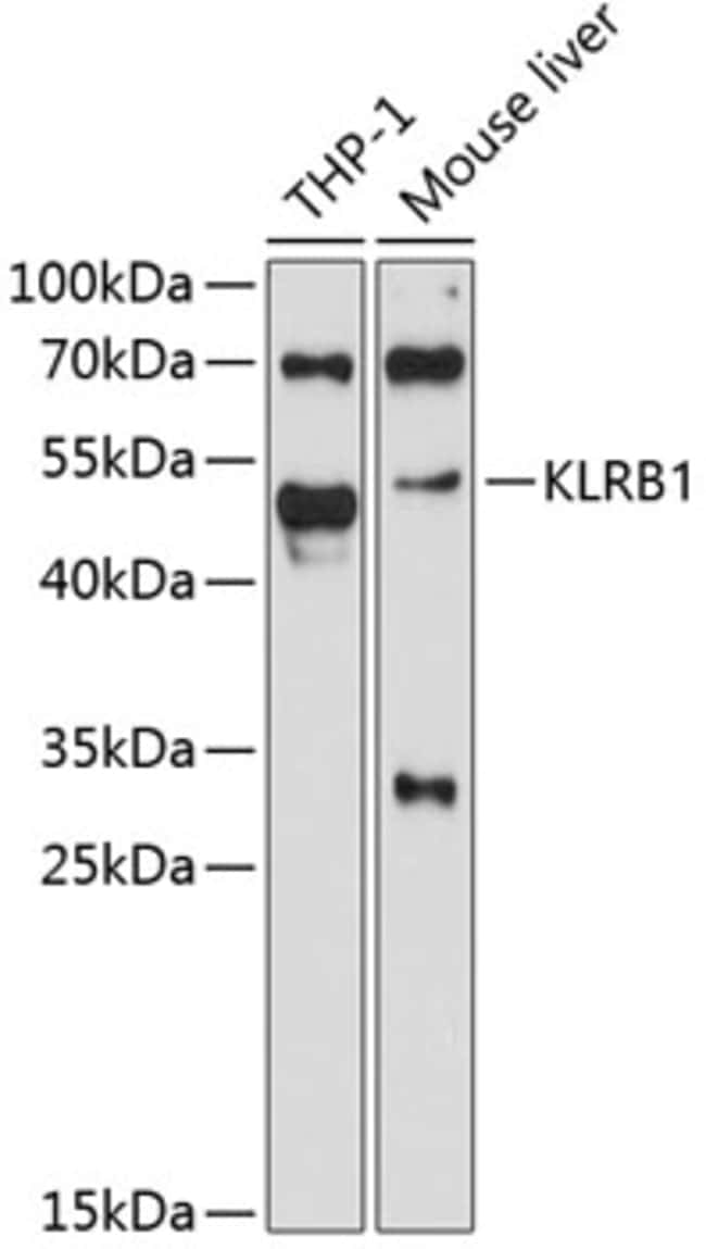 100UL KLRB1 ANTIBODY 100 ul