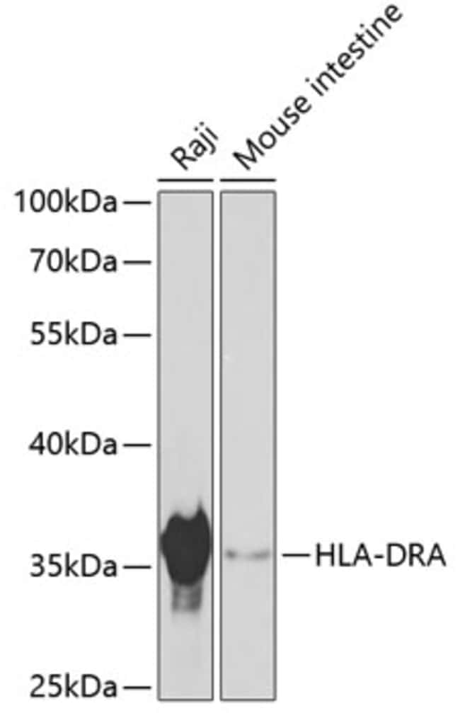 100UL HLA-DRA ANTIBODY 100 ul