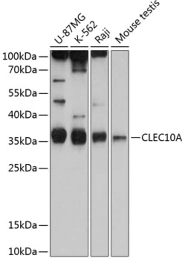 100UL CD301 ANTIBODY 100 ul