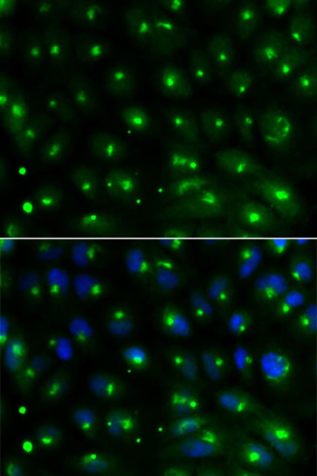 100UL GGA2 ANTIBODY 100 ul