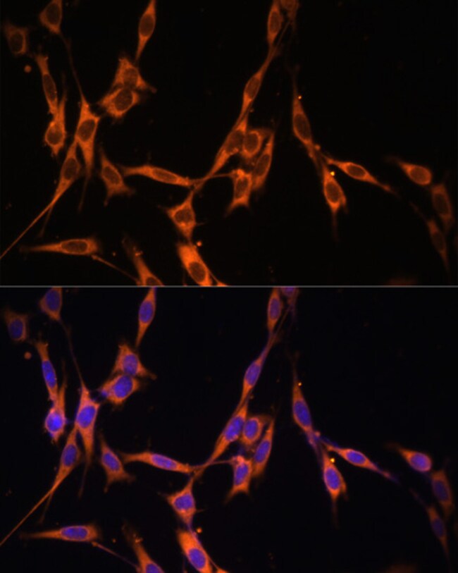 100UL KRAS ANTIBODY 100 ul