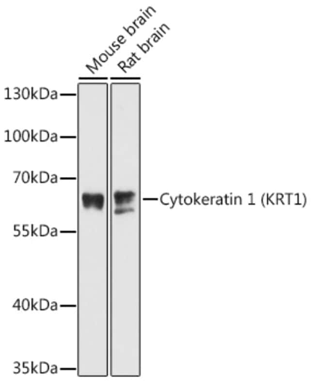 100UL CYTOKERATIN 1 ANTIBODY 100 ul