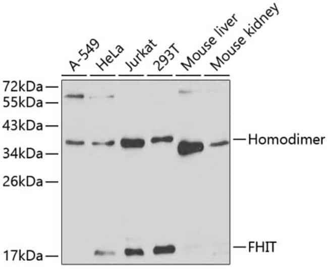 100UL FHIT ANTIBODY 100 ul