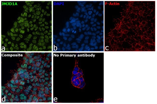 100UL JMJD1A ANTIBODY 100 ul