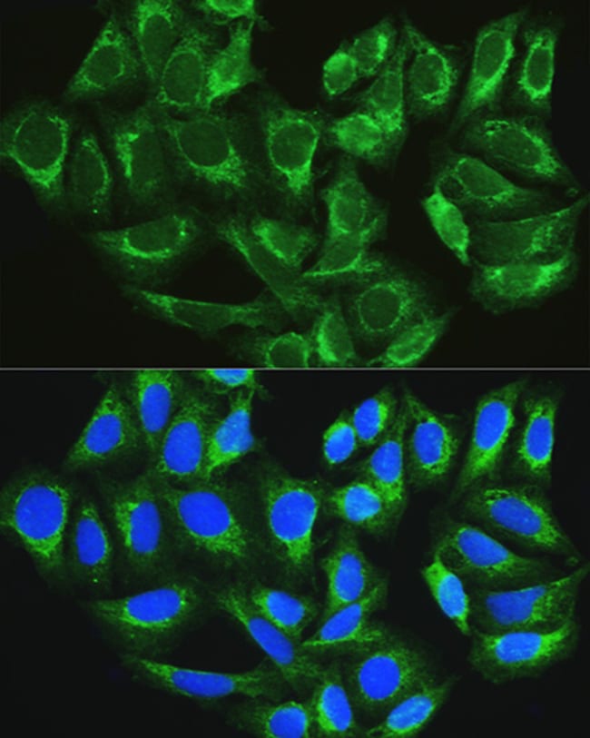 100UL ATG16L1 ANTIBODY 100 ul