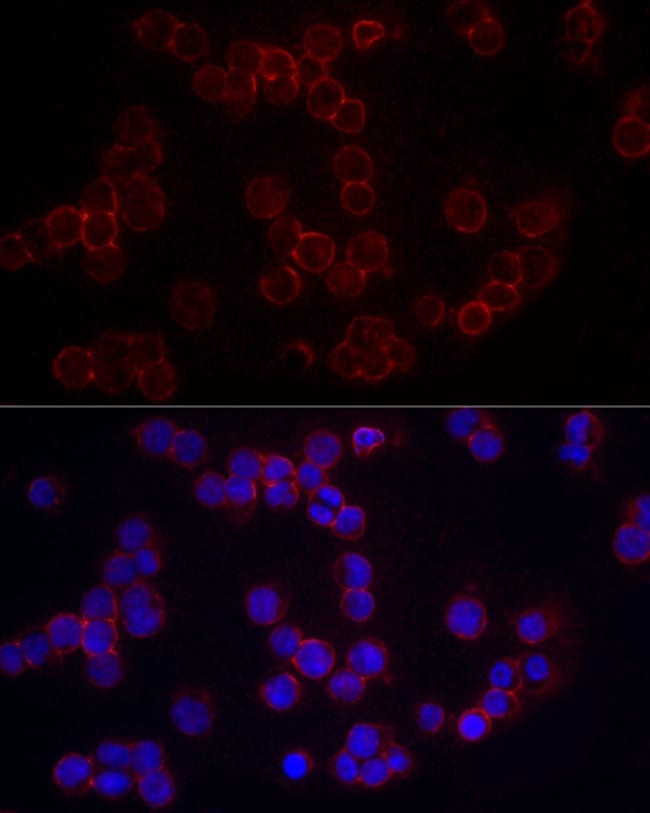 100UL CD86 ANTIBODY 100 ul