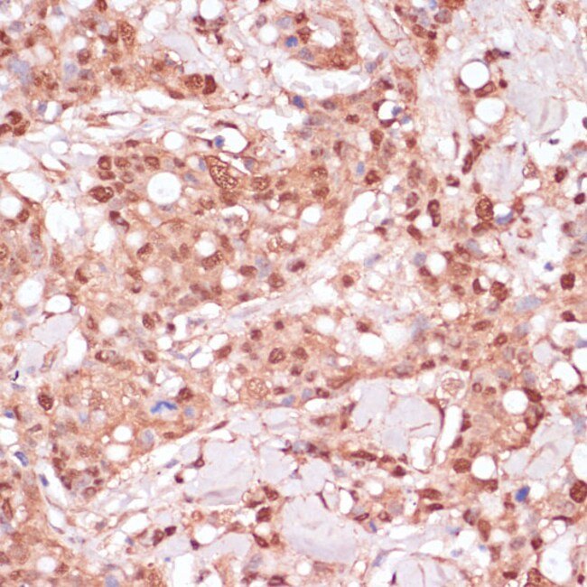 100UL BYSL ANTIBODY 100 ul