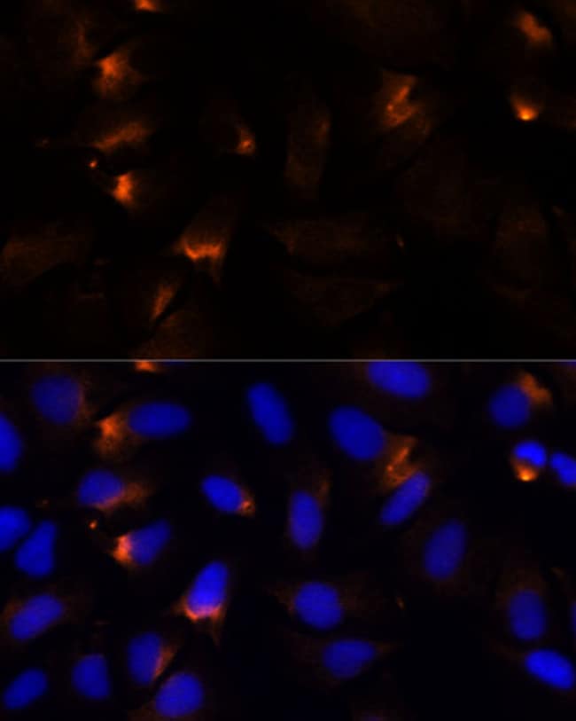 100UL MMP3 ANTIBODY 100 ul