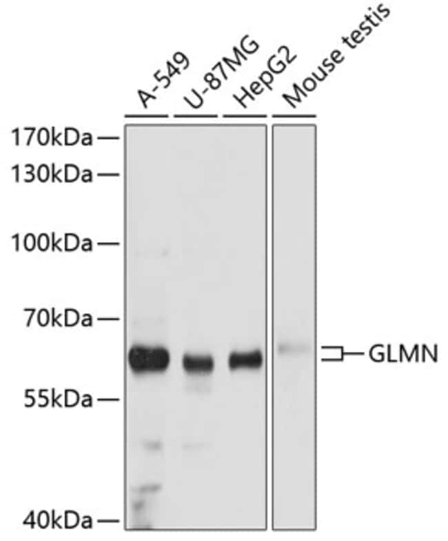 100UL GLMN ANTIBODY 100 ul