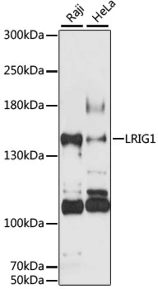 100UL LRIG1 ANTIBODY 100 ul