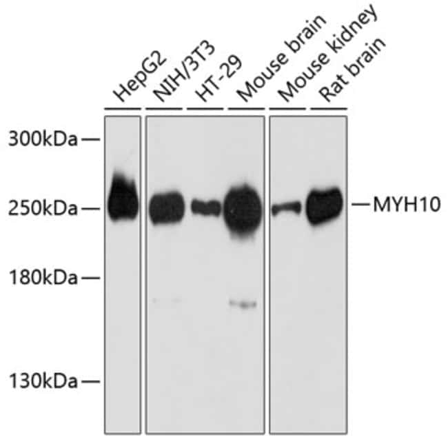100UL MYH10 ANTIBODY 100 ul