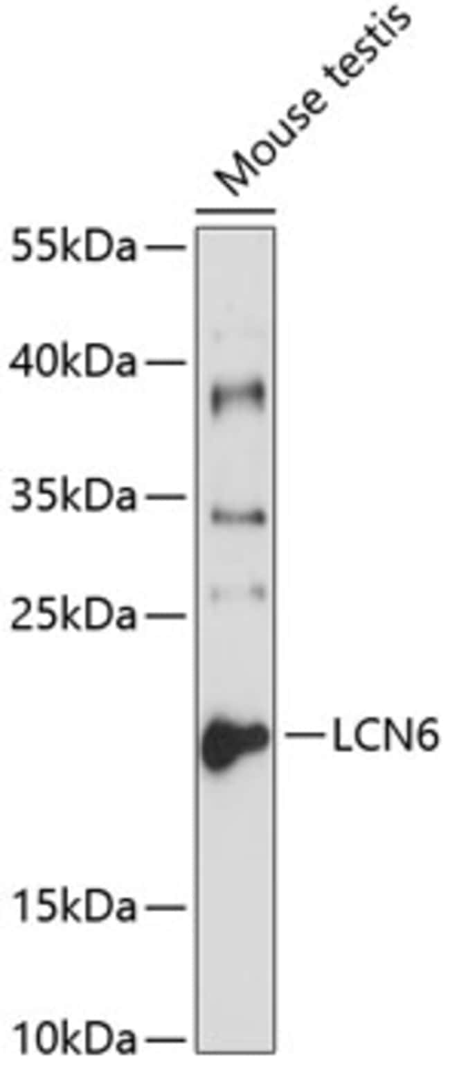 100UL LCN6 ANTIBODY 100 ul