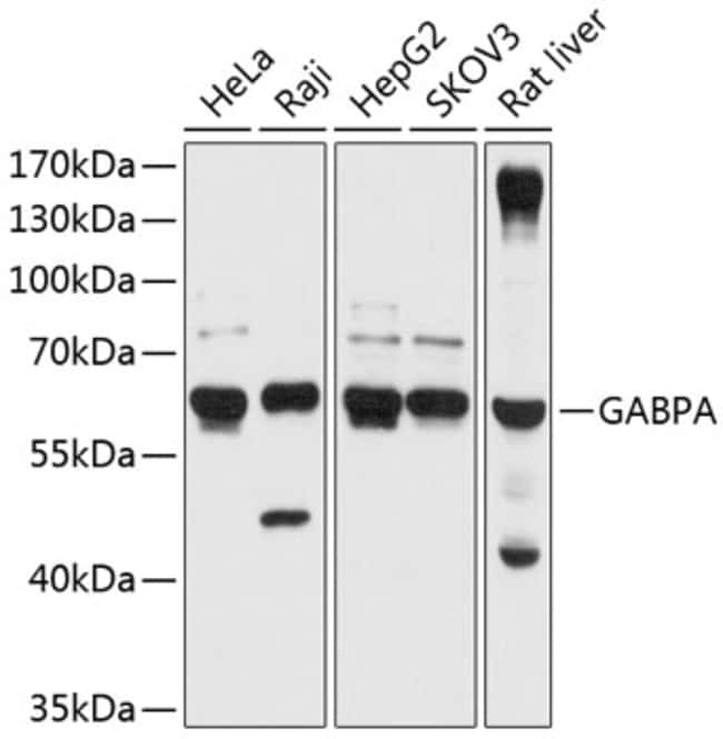 100UL GABPA ANTIBODY 100 ul