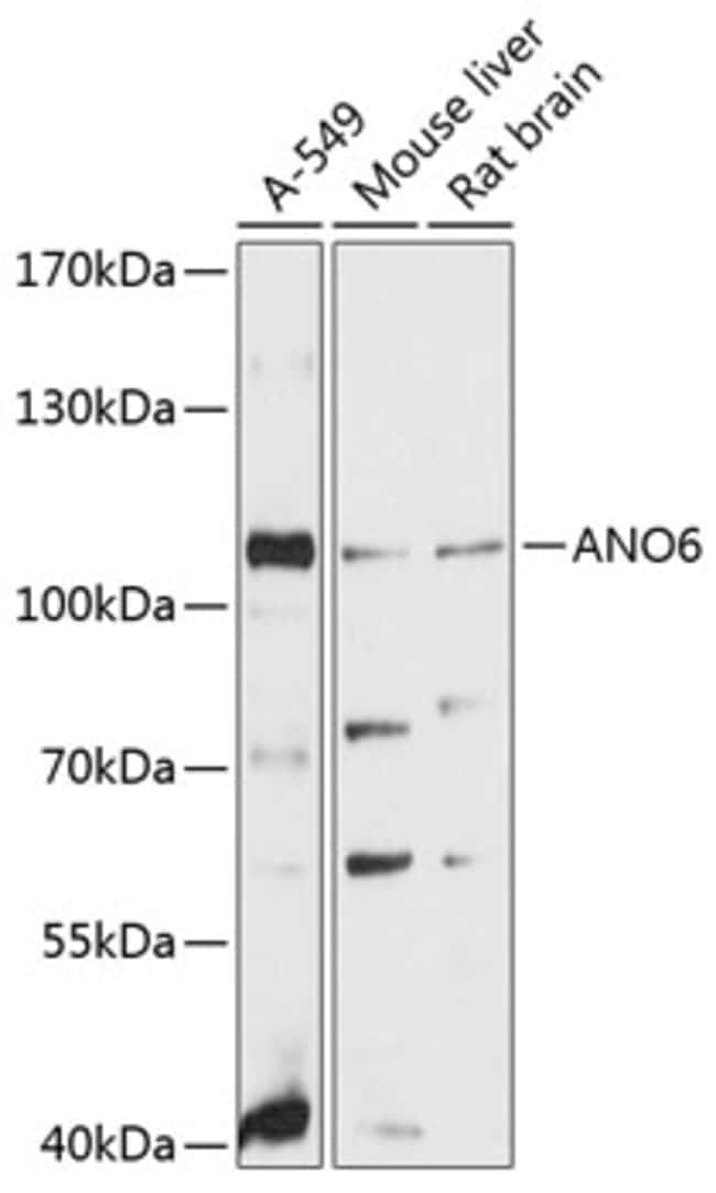100UL ANO6 ANTIBODY 100 ul