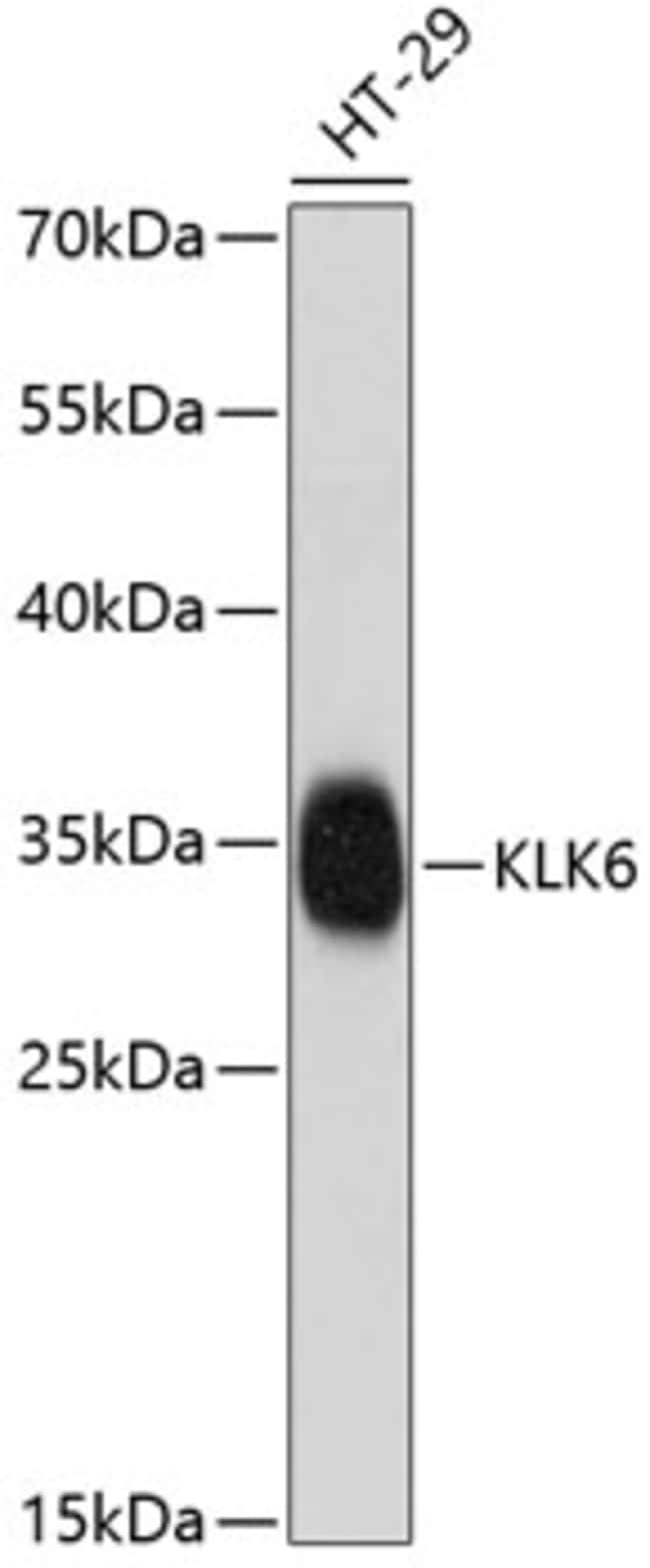 100UL KALLIKREIN 6 ANTIBODY 100 ul