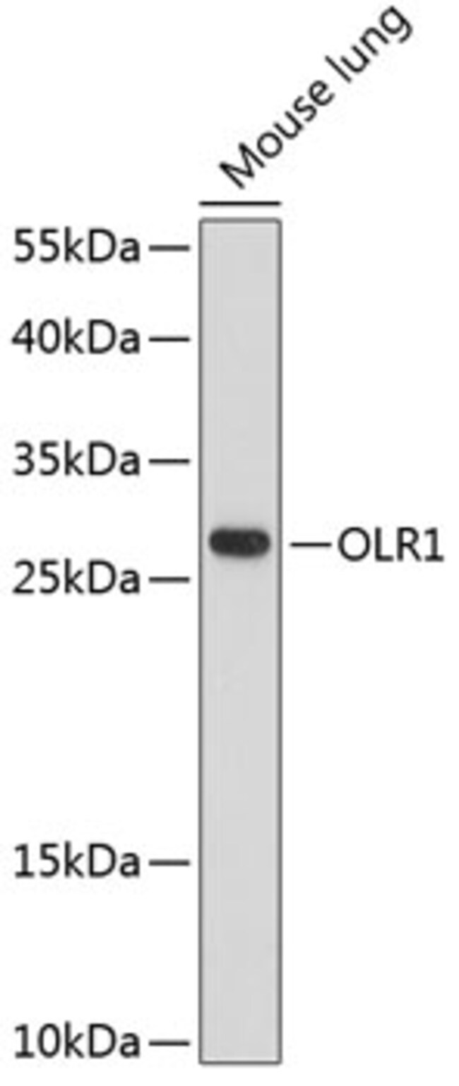 100UL LOX-1 ANTIBODY 100 ul