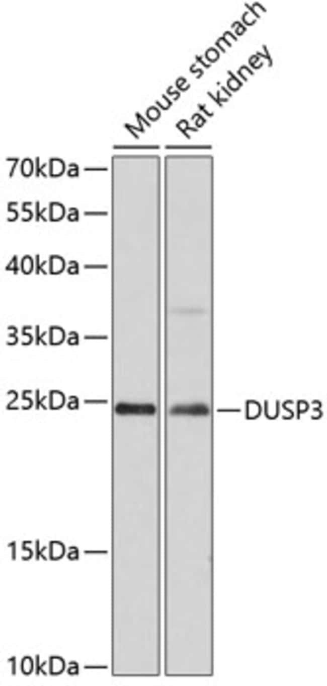 100UL DUSP3 ANTIBODY 100 ul