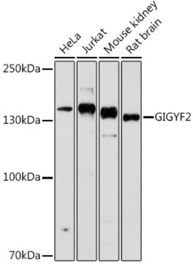 100UL GIGYF2 ANTIBODY 100 ul