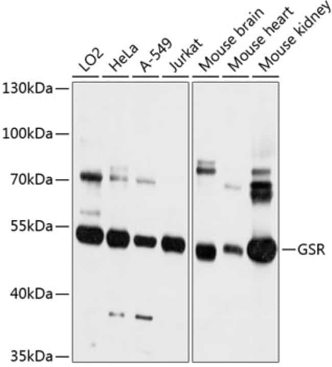 100UL GSR ANTIBODY 100 ul