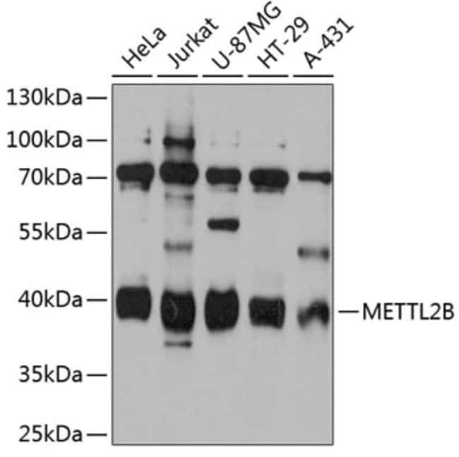 100UL METTL2B ANTIBODY 100 ul