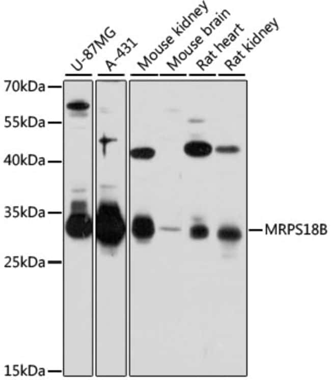100UL MRPS18B ANTIBODY 100 ul