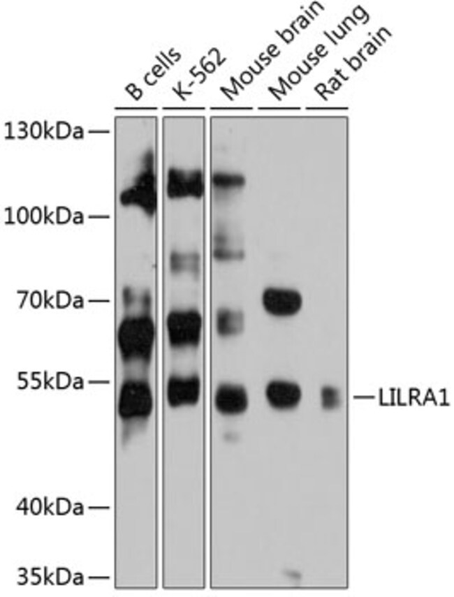 100UL LILRA1 ANTIBODY 100 ul